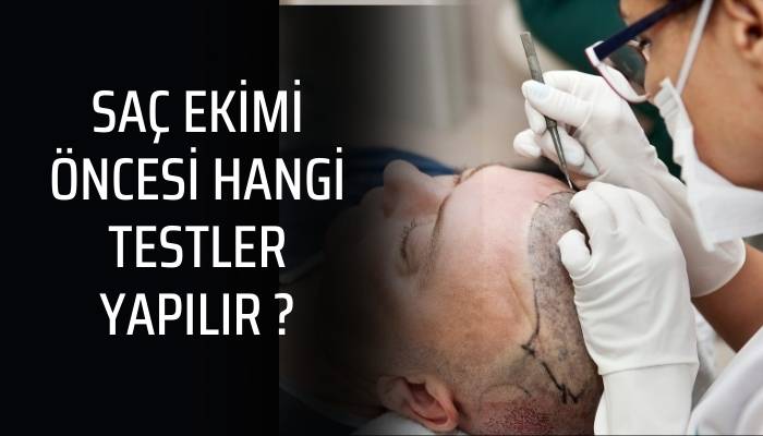 Saç Ekimi Öncesinde Hangi Testler Yapılır?