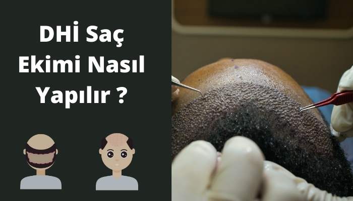 DHİ Saç Ekimi Nasıl Yapılır?