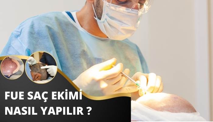 Fue Saç Ekimi Nasıl Yapılır ?