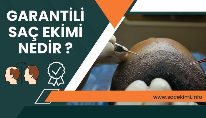 Garantili Saç Ekimi Nedir ?