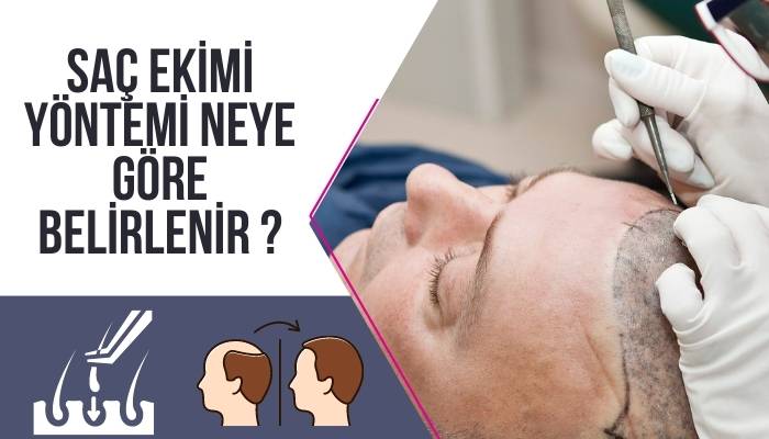 Saç Ekim Yöntemi Neye Göre Belirlenir ?