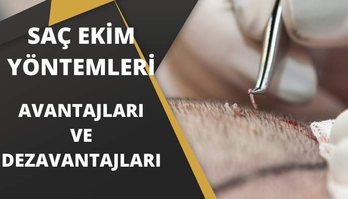 Saç Ekim Yöntemleri Avantajları ve Dezavantajları