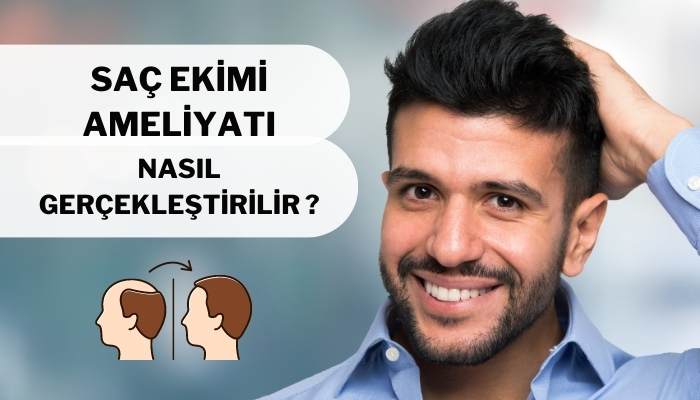 Saç Ekimi Ameliyatı Nasıl Gerçekleştirilir