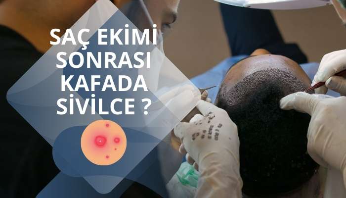 Saç Ekimi Sonrasında Kafada Sivilce