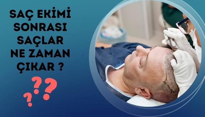 Saç Ekimi Sonrası Saçlar Ne Zaman Çıkar?