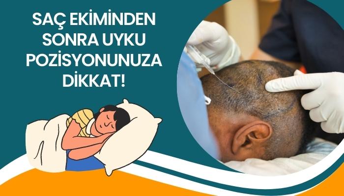 Saç Ekiminden Sonra Uyku Pozisyonuna Dikkat!