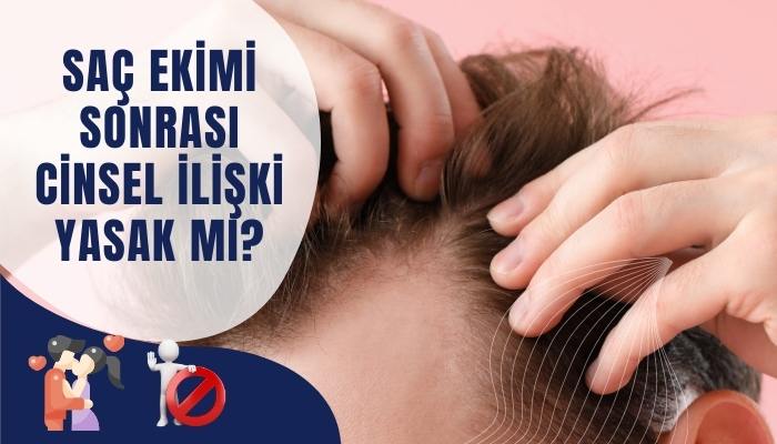 Saç Ekimi Sonrasında Cinsel İlişki Yasak Mı?