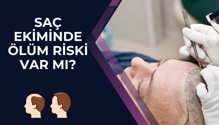 Saç Ekiminde Ölüm Riski Var Mı?