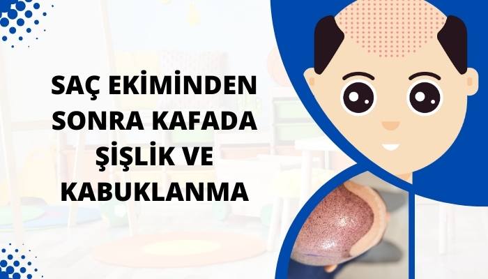 Saç Ekiminden Sonra Kafada Şişlik ve Kabuklanma