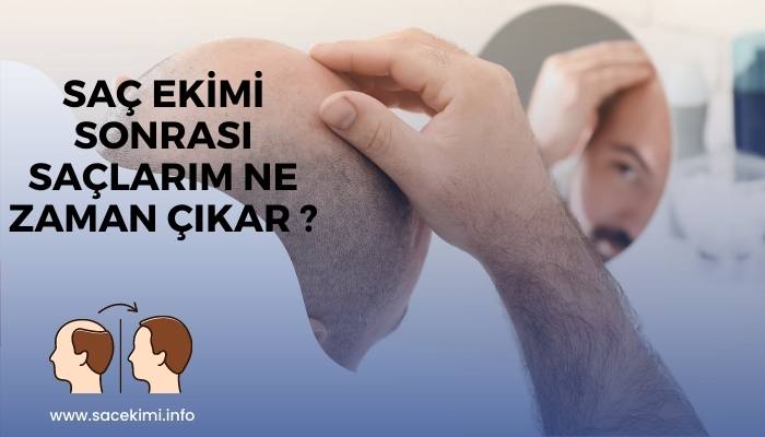 Saç Ekiminden Sonra Saçlar Ne Zaman Çıkar