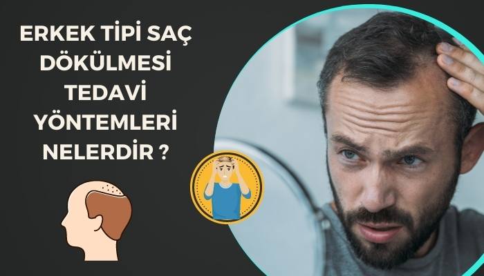 Erkek Tipi Saç Dökülmesi Tedavi Yöntemleri Nelerdir?