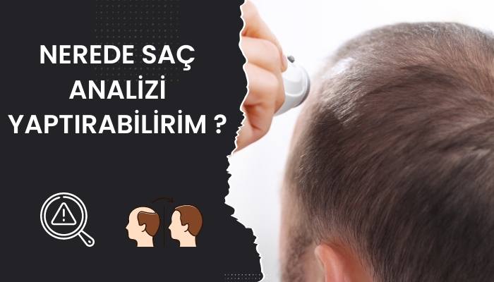 Nerede Saç Analizi Yaptırabilirim ?