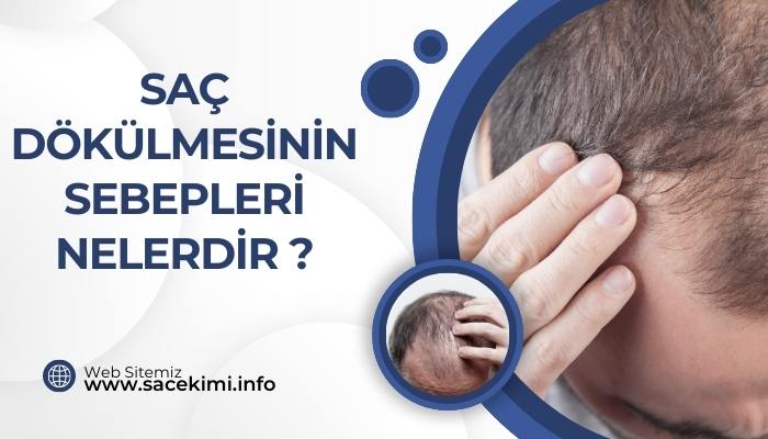 Saç Dökülmesinin Sebepleri Nelerdir ?