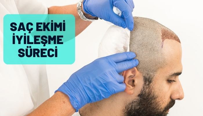 Saç Ekimi İyileşme Süreci