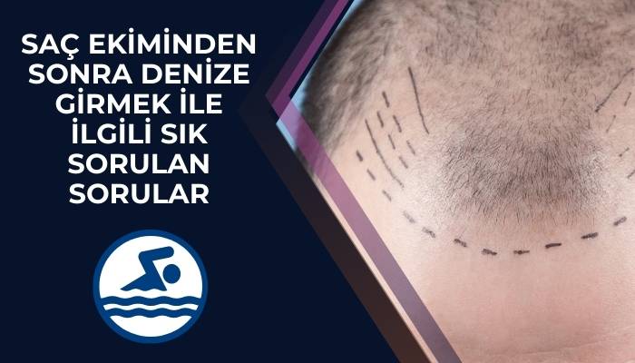 Saç Ekiminden Sonra Denize Girmek ile İlgili Sık Sorulan Sorular