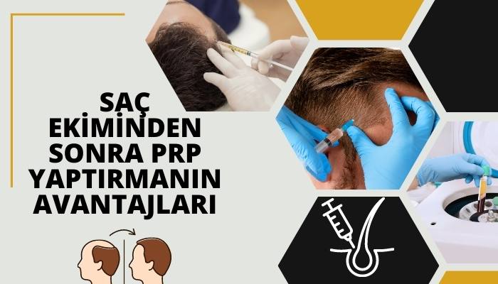 Saç Ekiminden Sonra PRP Yaptırmanın Avantajları