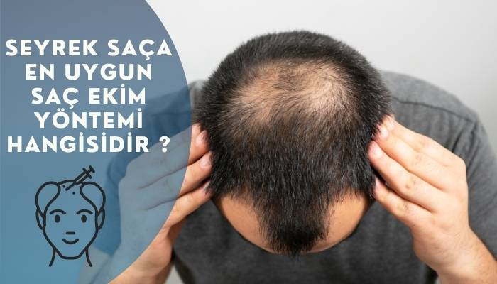 Seyrek Saçlara En Uygun Saç Ekim Yöntemi ?