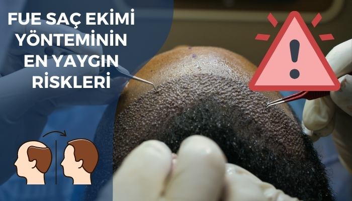 Fue Saç Ekiminin En Yaygın Riskleri Nelerdir?