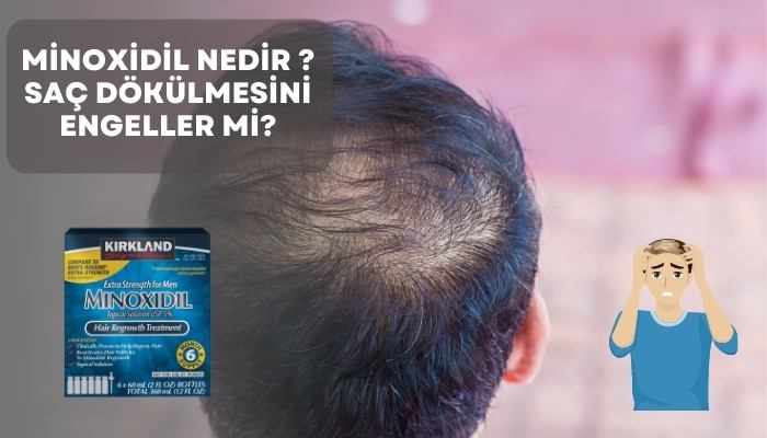 Minoxidil Nasıl Kullanılır ? Saç Dökülmesini Engeller mi?