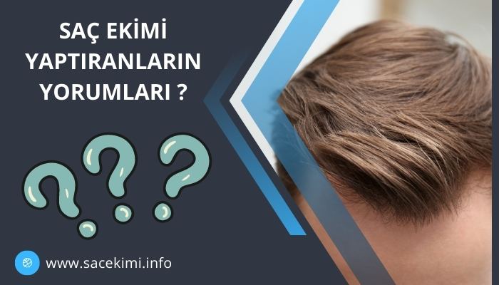 Saç Ekimi Yaptıranların Yorumları