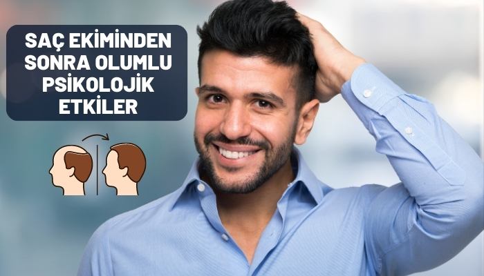 Saç Ekiminden Sonra Olumlu Psikolojik Etkiler